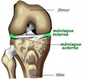 menisque-1